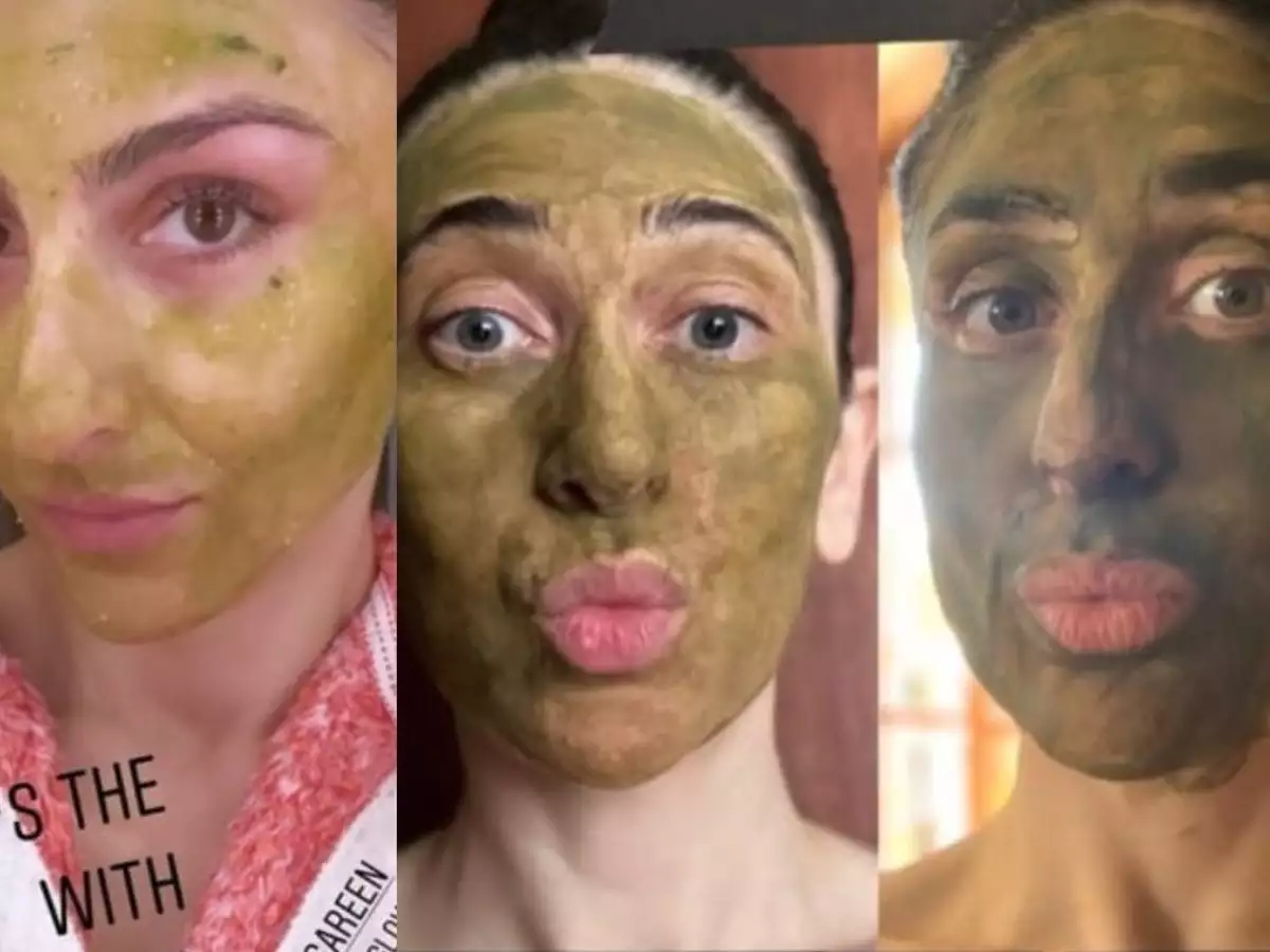 Celebrities Favourite DIY Acne Fighting Remedies