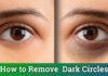 How to remove dark circles under eyes permanently at home without any medicine?